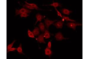 ABIN6274418 staining HepG2 by IF/ICC. (MAP4K3 antibody  (N-Term))