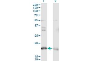Western Blot analysis of NDUFA8 expression in transfected 293T cell line by NDUFA8 monoclonal antibody (M05), clone 2E10.