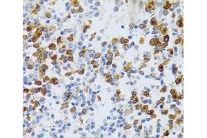 Immunohistochemistry of paraffin-embedded Human tonsil using CHAF1B Polyclonal Antibody at dilution of 1:100 (40x lens). (CHAF1B antibody)
