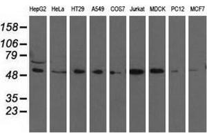 Western blot analysis of extracts (35 µg) from 9 different cell lines by using anti-TCP11L2 monoclonal antibody. (TCP11L2 antibody)
