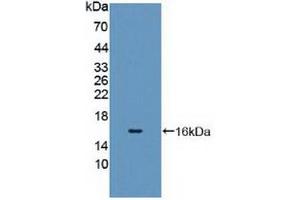 Detection of Recombinant CYP11A1, Human using Polyclonal Antibody to Cytochrome P450 11A1 (CYP11A1) (CYP11A1 antibody  (AA 392-521))