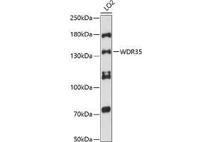 Western blot analysis of extracts of LO2 cells, using WDR35 antibody (ABIN6132986, ABIN6150192, ABIN6150193 and ABIN6216589) at 1:3000 dilution. (WDR35 antibody  (AA 871-1170))