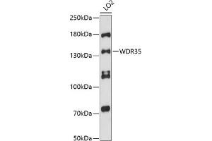 WDR35 antibody  (AA 871-1170)