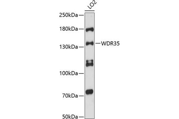 WDR35 antibody  (AA 871-1170)