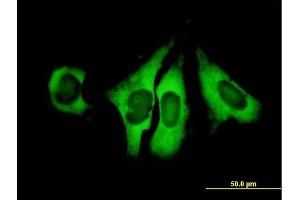 Immunofluorescence of purified MaxPab antibody to EIF4G1 on HeLa cell. (EIF4G1 antibody  (AA 1-645))