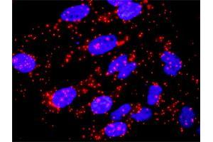Proximity Ligation Analysis of protein-protein interactions between SKP1 and CACYBP. (SKP1 antibody  (AA 1-160))