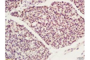 Formalin-fixed and paraffin embedded mouse embryo labeled with Rabbit Anti-FBXO11 Polyclonal Antibody, Unconjugated  at 1:200 followed by conjugation to the secondary antibody and DAB staining (FBXO11 antibody  (AA 65-160))