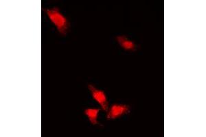 Immunofluorescent analysis of AKT (pS473) staining in MCF7 cells.