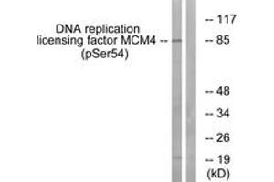 Western blot analysis of extracts from COS7 cells treated with nocodazole 1ug/ml 16h, using MCM4 (Phospho-Ser54) Antibody. (MCM4 antibody  (pSer54))