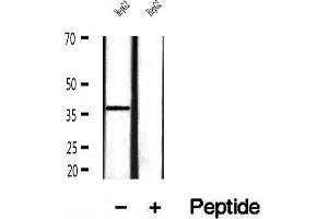 MAT2B antibody  (Internal Region)