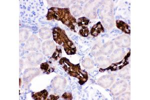 Immunohistochemistry (IHC) image for anti-Calbindin (CALB1) (AA 2-175) antibody (ABIN3043771)