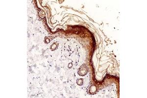 Immunohistochemistry of paraffin embedded rat skin using NCK (ABIN7074783) at dilution of 1:2000 (200x lens)