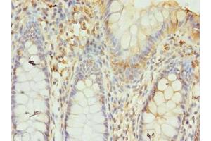 GTF3C6 antibody  (AA 2-213)