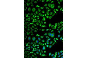 Immunofluorescence (IF) image for anti-Apolipoprotein D (APOD) antibody (ABIN1876485) (Apolipoprotein D antibody)