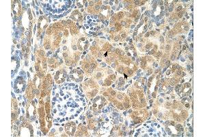 Immunohistochemistry (IHC) image for anti-Nuclear Receptor Subfamily 2, Group F, Member 2 (NR2F2) (N-Term) antibody (ABIN2781130) (NR2F2 antibody  (N-Term))