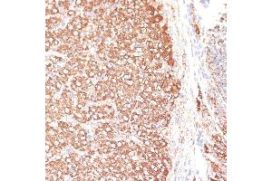 Immunohistochemistry of paraffin-embedded rat ovary using KCNS3 antibody (ABIN6132153, ABIN6142774, ABIN6142775 and ABIN6223897) at dilution of 1:100 (40x lens). (KCNS3 antibody  (AA 1-180))