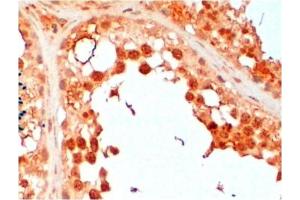 Paraffin Embedded Human Testis stained with UBE2R2 antibody at 2 μg/ml.