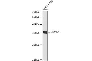 Western blot analysis of extracts of NCI-H460 cells, using NKX2-1 antibody (ABIN3017367, ABIN3017368, ABIN1681058 and ABIN6220056) at 1:500 dilution. (NKX2-1 antibody)