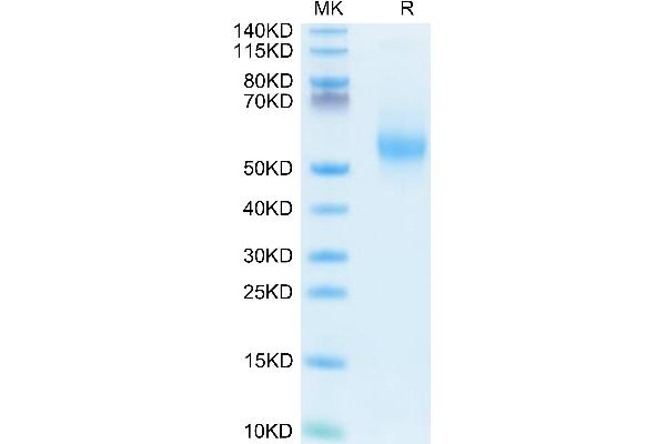 IL-3 Protein (AA 20-152) (Fc Tag)