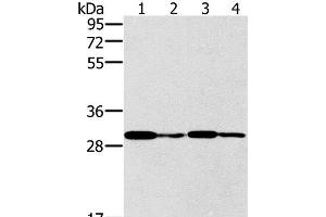 Western Blot analysis of K562 cell and Human liver cancer tissue, Jurkat and A549 cell using PNMT Polyclonal Antibody at dilution of 1:400 (PNMT antibody)