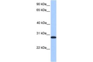 Western Blotting (WB) image for anti-Cyclin-Dependent Kinase Inhibitor 3 (CDKN3) antibody (ABIN2463585) (CDKN3 antibody)