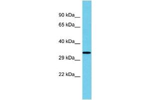Host: Rabbit Target Name: UBFD1 Sample Type: Fetal Kidney lysates Antibody Dilution: 1. (UBFD1 antibody  (Middle Region))