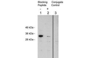 Image no. 1 for anti-Four and A Half LIM Domains 2 (FHL2) antibody (ABIN201816) (FHL2 antibody)