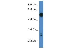 Western Blot showing Gal3st4 antibody used at a concentration of 1. (GAL3ST4 antibody  (C-Term))