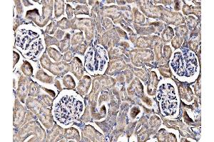IHC analysis of Integrin Linked ILK using anti-Integrin Linked ILK antibody (ABIN7599411). (ILK antibody  (AA 1-452))