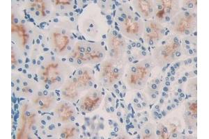 Detection of IL10 in Rat Kidney Tissue using Monoclonal Antibody to Interleukin 10 (IL10) (IL-10 antibody  (AA 19-178))