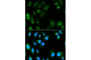Immunofluorescence analysis of MCF7 cell using UCP3 antibody. (UCP3 antibody  (AA 1-110))