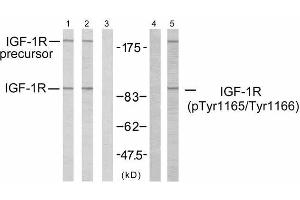 Western blot analysis using IGF-1R (Ab-1165/1166) antibody (E021081, Line 1, 2 and 3) and IGF-1R (phospho-Tyr1165/Tyr1166) antibody (E011088, Line 4 and 5). (IGF1R antibody)