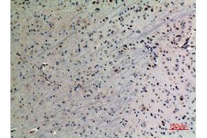 Immunohistochemistry (IHC) analysis of paraffin-embedded Mouse Brain, antibody was diluted at 1:100. (PPID antibody  (C-Term))