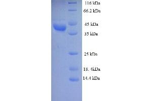 SDS-PAGE (SDS) image for Lactate Dehydrogenase D (LDHD) (AA 1-331), (full length) protein (His tag) (ABIN4974832) (LDHD Protein (AA 1-331, full length) (His tag))