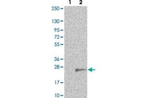Western blot analysis of Lane 1: Negative control (vector only transfected HEK293T lysate). (TMEM97 antibody)