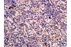 Formalin-fixed and paraffin embedded rat spleen labeled with Anti-GRB10/14 Polyclonal Antibody, Unconjugated  at 1:300 followed by conjugation to the secondary antibody and DAB staining. (GRB10/14 (AA 501-594) antibody)