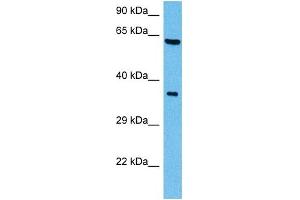 Western Blotting (WB) image for anti-SHC (Src Homology 2 Domain Containing) Transforming Protein 1 (SHC1) (C-Term) antibody (ABIN2784202)