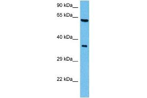 Host:  Mouse  Target Name:  SHC1  Sample Tissue:  Mouse Brain  Antibody Dilution:  1ug/ml (SHC1 antibody  (C-Term))