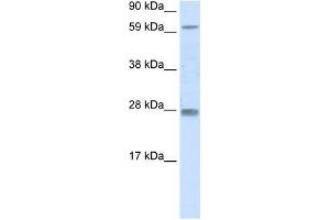 RHOX11 antibody used at 0. (RHOX11 antibody  (N-Term))