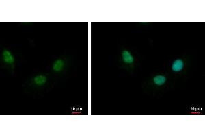 ICC/IF Image NTH1 antibody detects NTH1 protein at nucleus by immunofluorescent analysis. (Nth Endonuclease III-Like 1 (NTHL1) (Center) antibody)