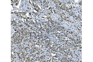 IHC analysis of eRF1/ETF1 using anti-eRF1/ETF1 antibody (ABIN7602626). (ETF1 antibody  (AA 9-342))