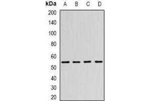 Western blot analysis of N-WASP expression in SW480 (A), MCF7 (B), mouse brain (C), mouse kidney (D) whole cell lysates. (Neural Wiskott-Aldrich syndrome protein (WASL) antibody)