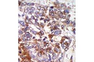 Image no. 2 for anti-Protein Kinase, CGMP-Dependent, Type I (PRKG1) (C-Term) antibody (ABIN360422) (PRKG1 antibody  (C-Term))