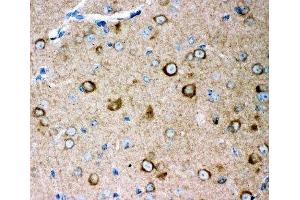 IHC-P: GLUR2 antibody testing of mouse brain tissue (GRIA2 antibody  (AA 25-360))