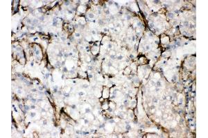 Anti- SLC10A1 Picoband antibody, IHC(P) IHC(P): Human Liver Cancer Tissue (SLC10A1 antibody  (C-Term))