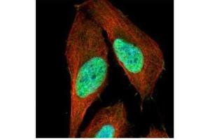 ICC/IF Image Confocal immunofluorescence analysis (Olympus FV10i) of paraformaldehyde-fixed U2OS, using p53, antibody (Green) at 1:500 dilution. (p53 antibody)