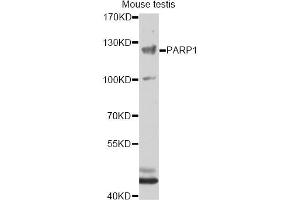 Western blot analysis of extracts of mouse testis, using PARP1 antibody (ABIN5995673) at 1/1000 dilution. (PARP1 antibody)