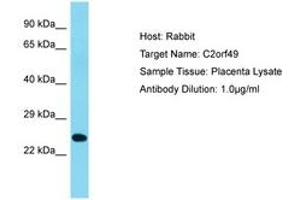 Image no. 1 for anti-Chromosome 2 Open Reading Frame 49 (C2orf49) (AA 93-142) antibody (ABIN6750665) (C2orf49 antibody  (AA 93-142))