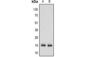 Western blot analysis of IFN alpha 1 expression in MCF7 (A), A549 (B) whole cell lysates. (IFNA1 antibody  (C-Term))