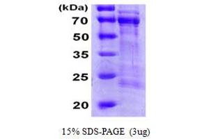 SDS-PAGE (SDS) image for Cell Division Cycle 25 Homolog A (S. Pombe) (CDC25A) (AA 1-524) protein (His tag) (ABIN6386706)